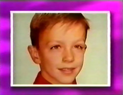 David Cassidy before his eye surgery